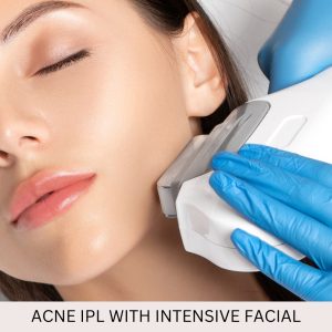 Acne IPL Treatment  with Intensive Facial