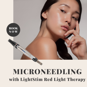 The Ultimate Guide to Microneedling: Rejuvenate Your Skin and Boost Collagen Production